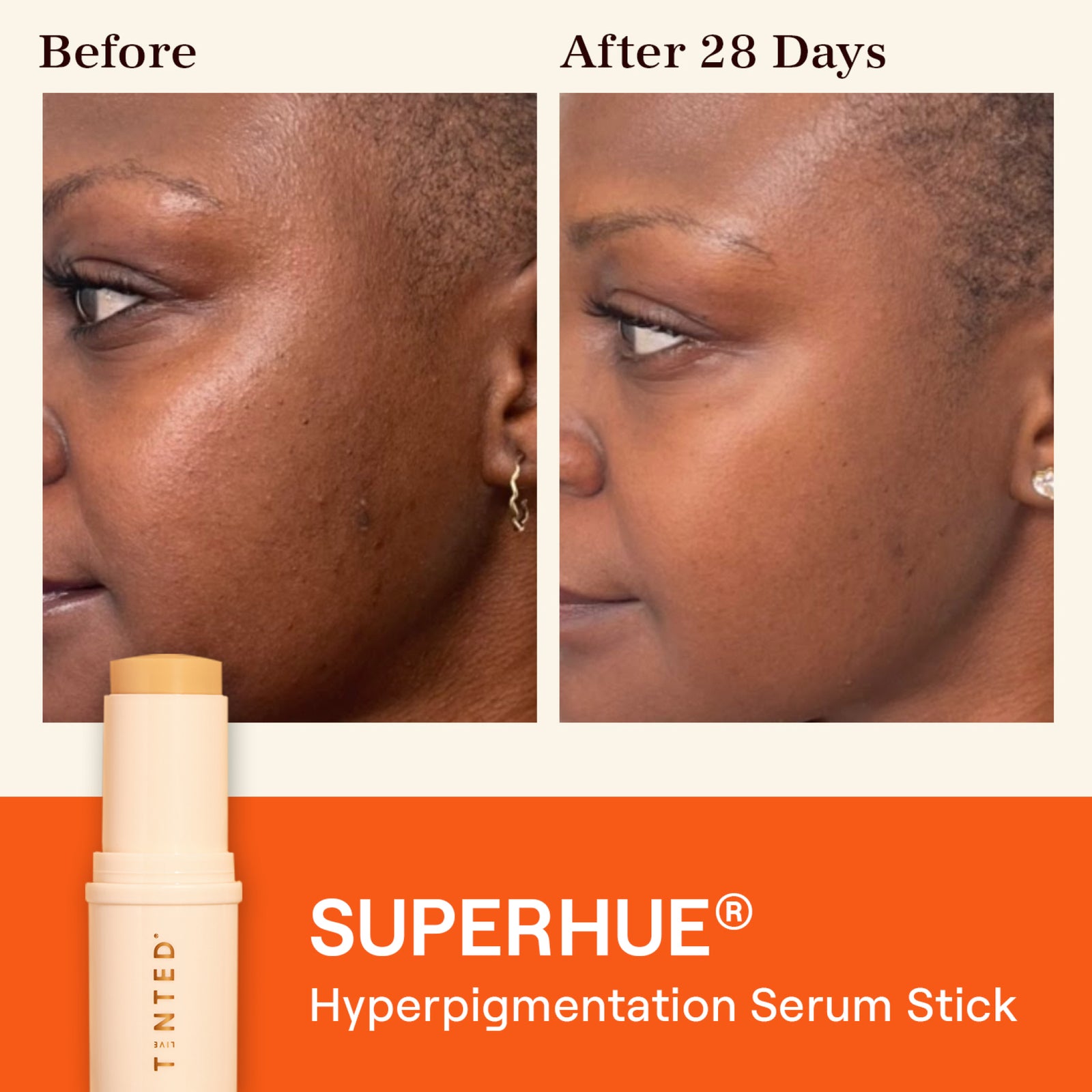 SUPERHUE® Hyperpigmentation Serum Stick