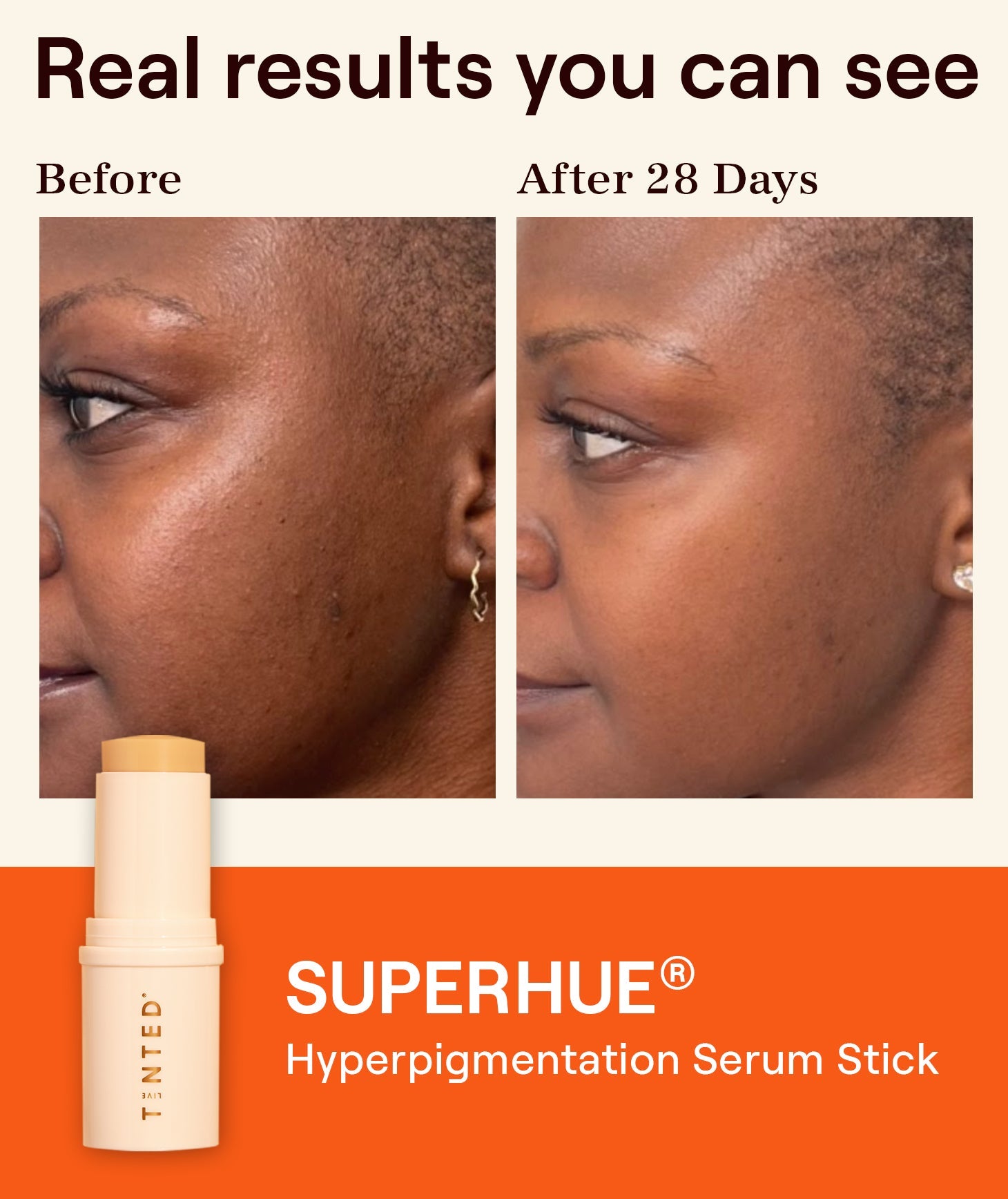 Mini Superhue Hyperpigmentation Serum Stick