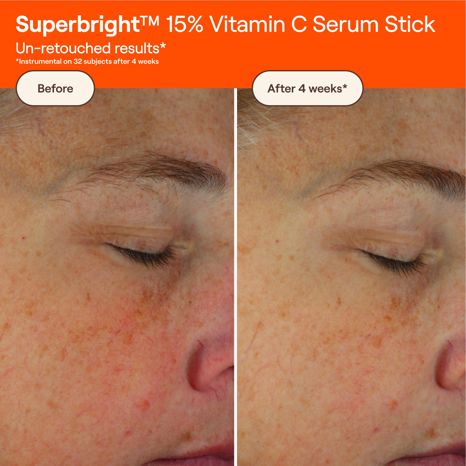 SUPERBRIGHT™ 15% Vitamin C Serum Stick