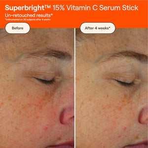 SUPERBRIGHT™ 15% Vitamin C Serum Stick