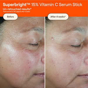 SUPERBRIGHT™ 15% Vitamin C Serum Stick