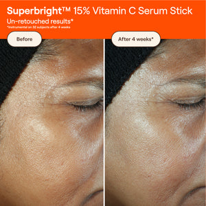 SUPERBRIGHT™ 15% Vitamin C Serum Stick
